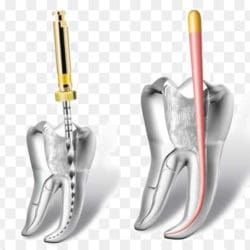endodontia mecanizada endodontia mecanizada